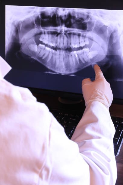 Best Emergency Care for Gum Disease in Belmont, WI