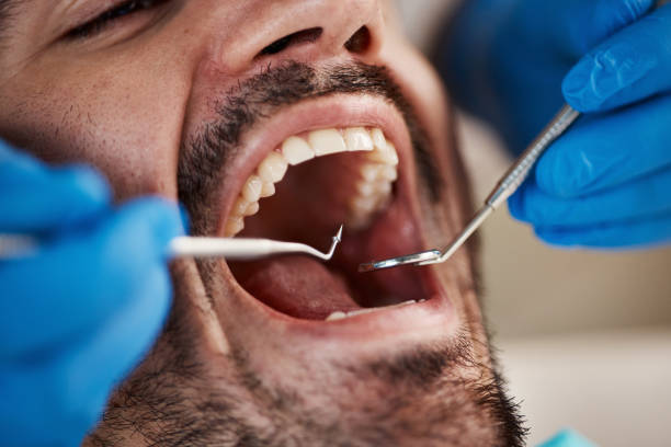 Best Emergency Treatment for Oral Infections in Belmont, WI
